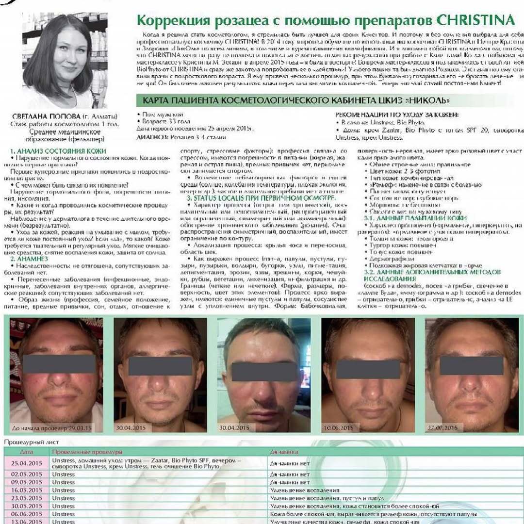 Научная статья о розацеа